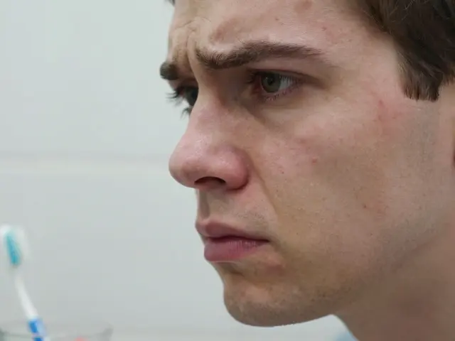 Jak rychle vyléčit akné: Ověřené metody a dermokosmetika pro čistou pleť